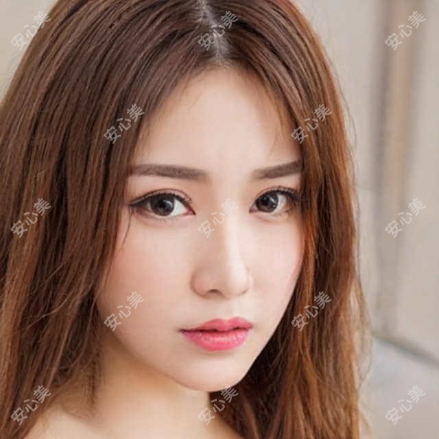 盛十中牙齿修复疗效如何?蚌埠韩丽口腔医生信息一览