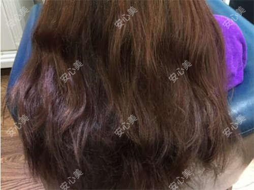 北京市后牙种植牙医院价格对比:赛德阳光口腔8000元起,北京倪氏6500元起,多面解析种植牙费用与材料