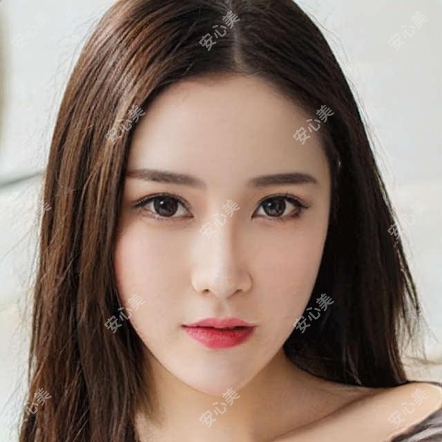 佛山德国蔡司睛雕个性化飞秒多少钱?2025收费表发布了~佛山德国蔡司睛雕个性化飞秒具体收费快去看!