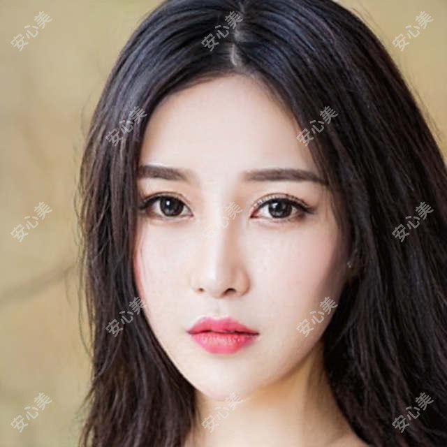 2025年北京熙朵植发价格表收费标准一览:3D微针|FUE|加密|美人尖|发际线|疤痕种植|鬓角种植|胡须种植价格表