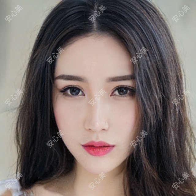 2025成都郫都区骨科医院价格表公开:郫都骨科上睑下垂矫正费用及项目详解