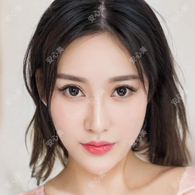 长春赵胜有医生做自体脂肪移植怎么样?他30年经验技术亮点解析
