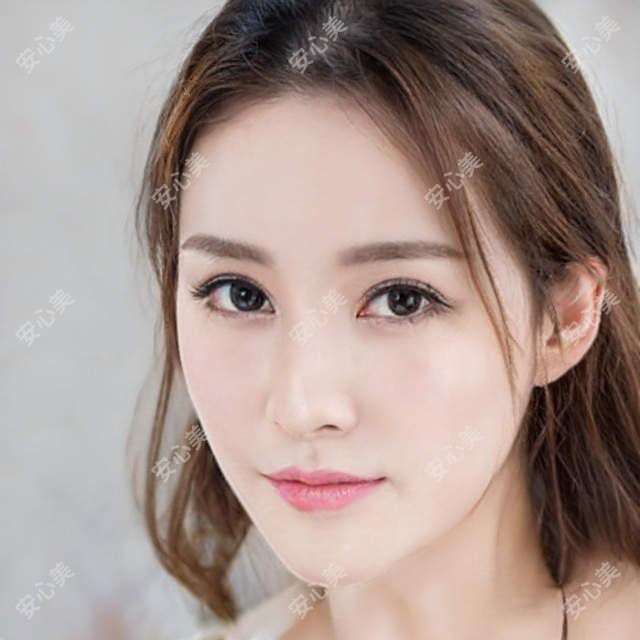 成都市眼睑内翻矫正手术费用对比:康桥眼科医院5000元 vs 新华厦眼科医院6000元价格表实用指南