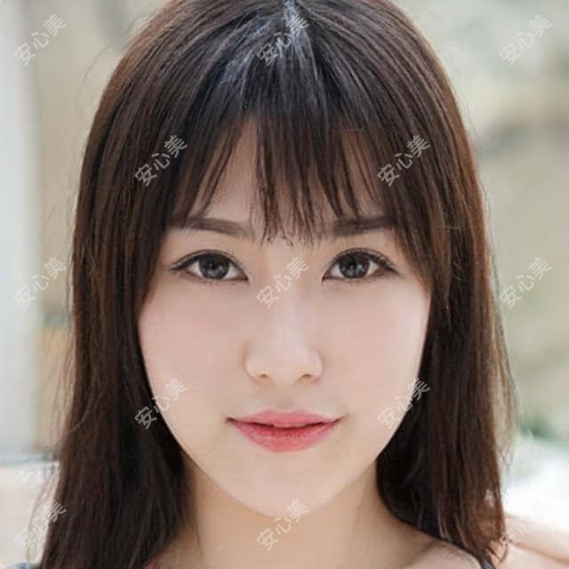 广州至简整形&广州臻妃微创富贵包手术仅需3800元起,详解微创治疗疗效与恢复时间