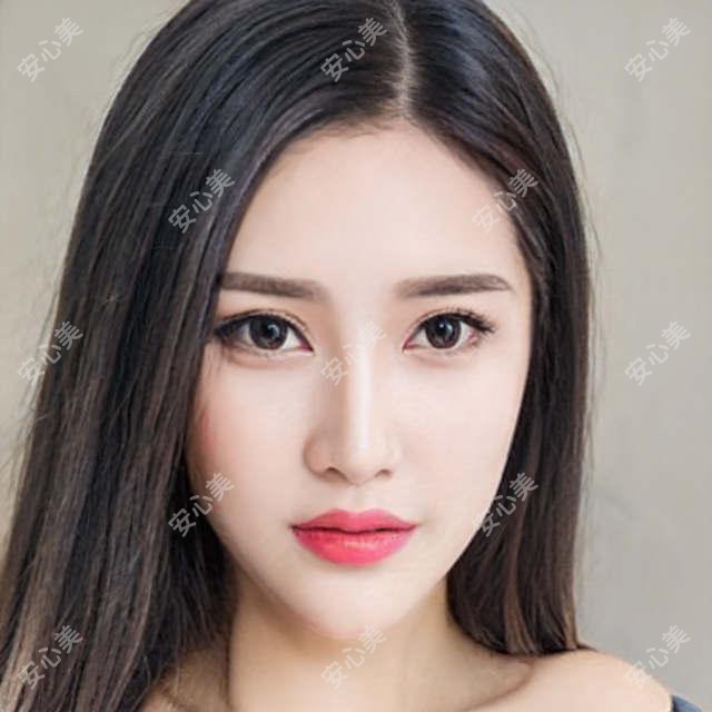 成都悦好医美价格全公开:热玛吉、玻尿酸、双眼皮项目费用一览