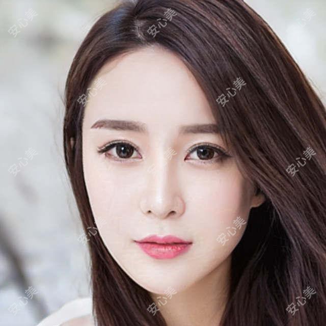 上海新视界眼科医院与和平眼科医院突眼矫正手术价格对比表:新视界8000元起,和平眼科7500元起