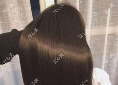 台州艺星祁薇医生面部年轻化测评:16年经验定制抗衰方案,激光祛斑痤疮疗效自然