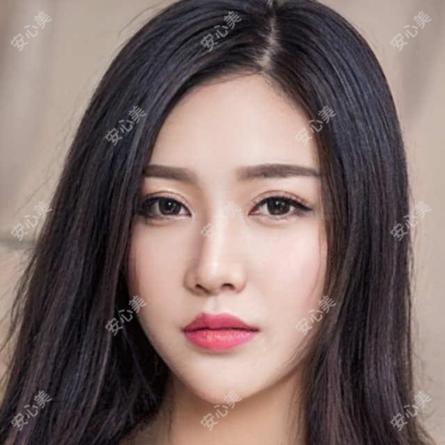 长沙热玛吉多少钱一次?热玛吉全脸抗衰价格8K~1.5W起靠谱吗