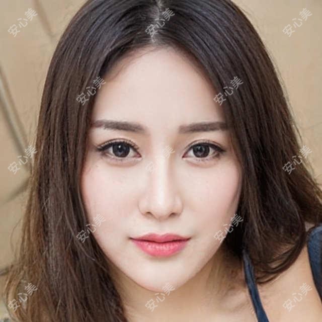 连云港丰面颊价格多少?靠谱医院推荐+费用明细大公开