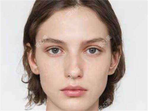 保定去法令纹需要做几次 价格和疗效排名解析