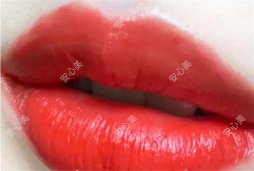 成都恒美植发项目价格揭秘:植发养发套餐8800元起,眉毛种植6600实惠