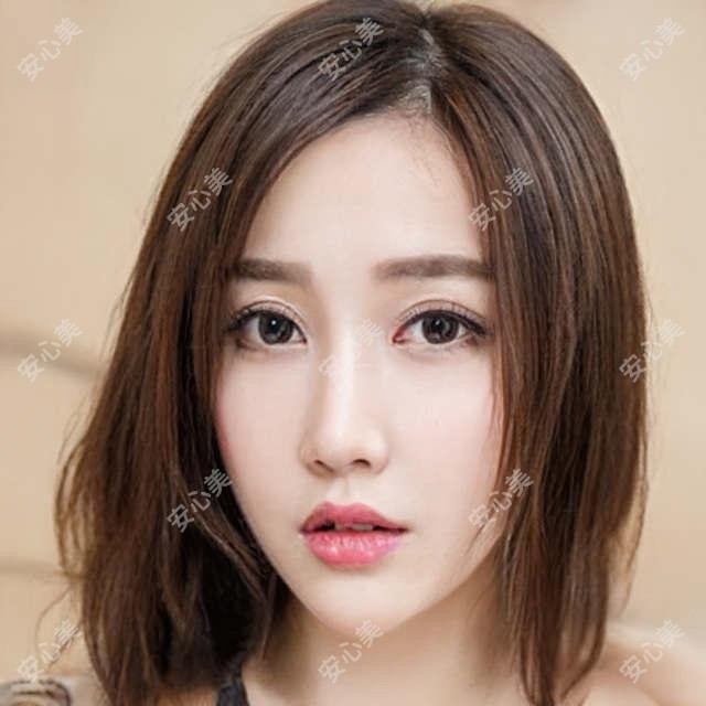 深圳新视代眼科全项目详解:近视激光8800元起,双眼皮5800元实惠