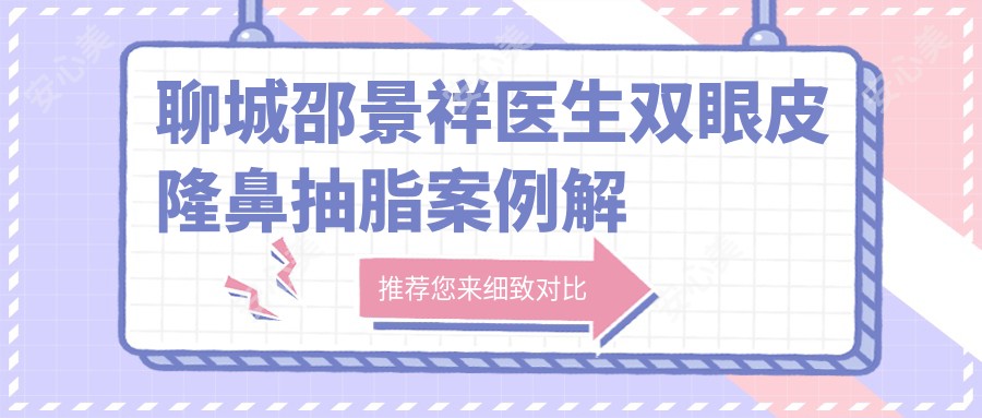 聊城邵景祥医生双眼皮隆鼻抽脂实例解析-聊城市人民医院整形医生