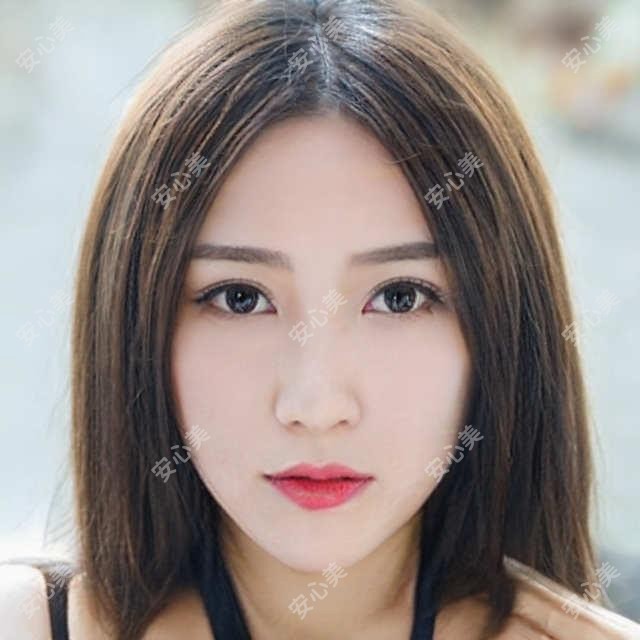 吴仁毅眼科医生-丽水华厦吴仁毅青光眼白内障手术方案灵活口碑好