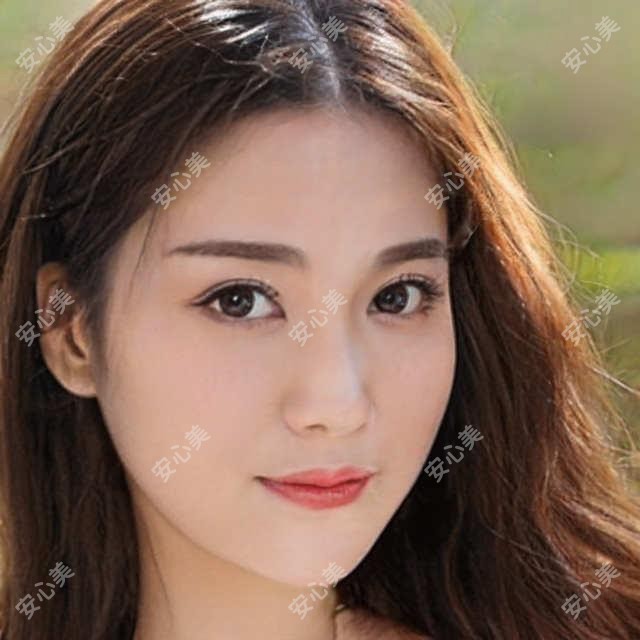 泰安直角肩项目选择指南 大分子与中分子填充疗效及价格对比