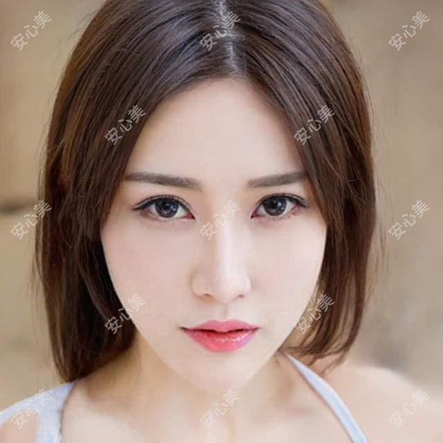 马鞍山黄金超光子体验分享!3980元值不值?怕痛星人也能安心做