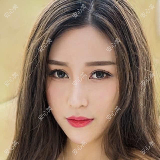 北京市熙仁眼科飞秒手术多少钱？近视矫正1W+ 散光治疗8K+ 老花眼晶体置换2W+