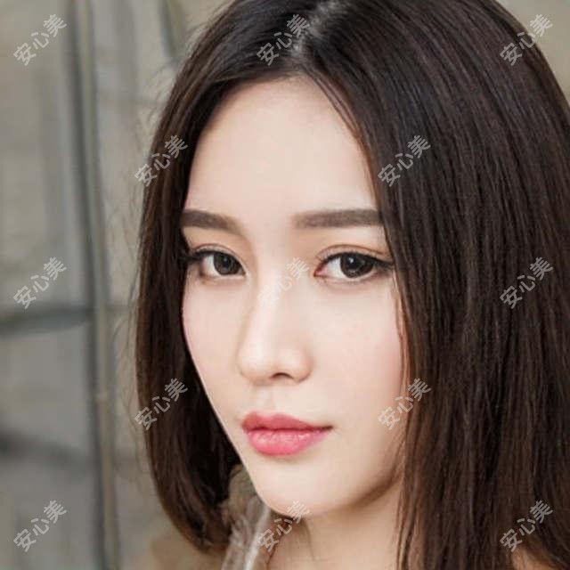 成都小青草眼科全项目价格揭秘,近视激光、白内障手术等热门医美项目费用一览
