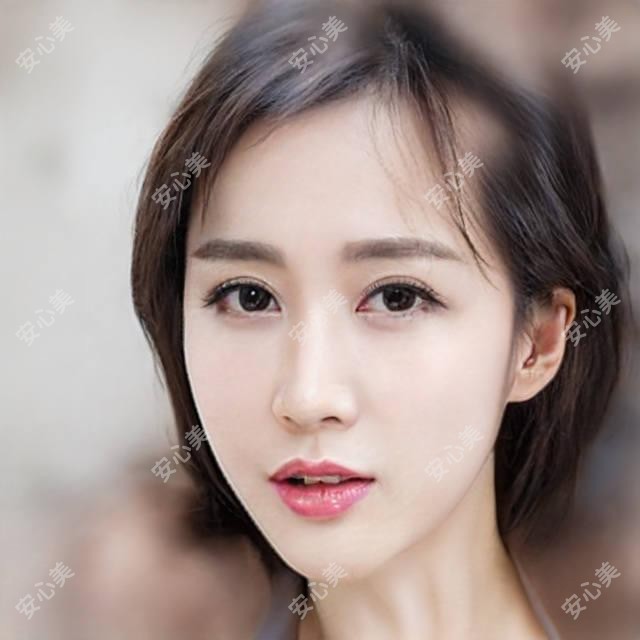 北京美尔目定慧医院医美价格表:玻尿酸丰臀6800+|自体脂肪丰臀15800+|臀部吸脂9800+