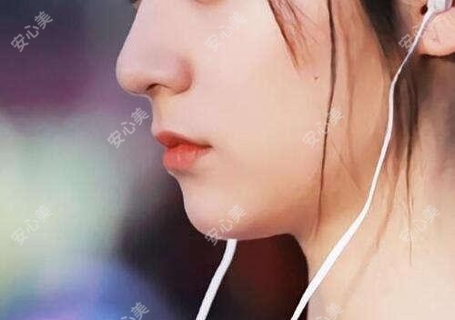 深圳医美哪家强?广尔美丽vs美莱vs星荟丽格,双眼皮&玻尿酸口碑测评