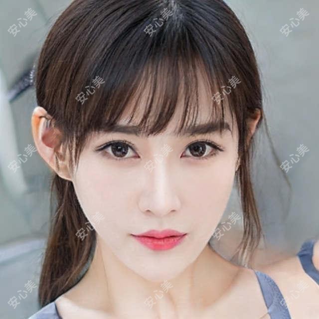 广东深圳莱悦口腔牙齿矫正多少钱?金属托槽8K+/隐形矫正2W+/舌侧矫正3W+