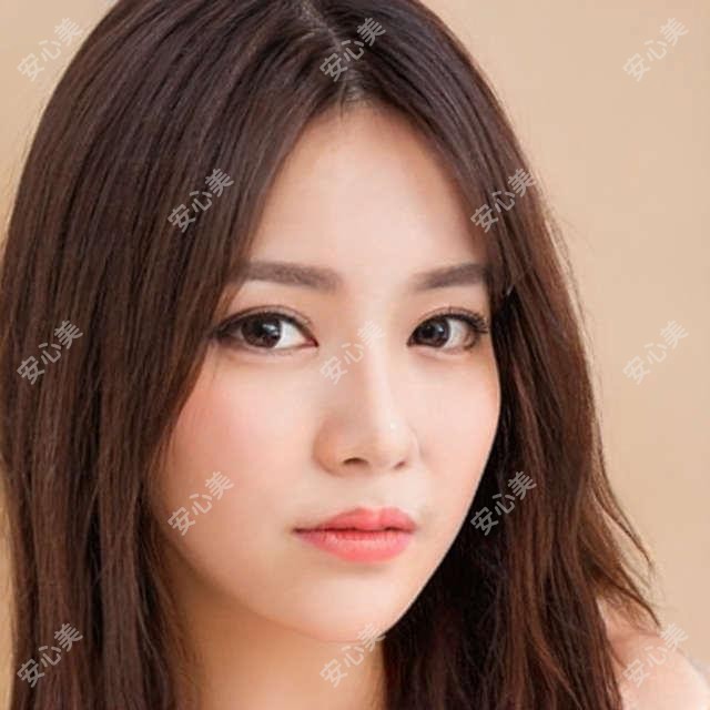 深圳倍生植发VS鹏程植发科：发际线调整+美人尖种植真实体验分享