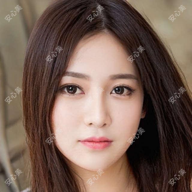 厦门液态鼻综合|1.8w起重塑精致鼻型 自然妈生感太绝了!术后即刻上班!