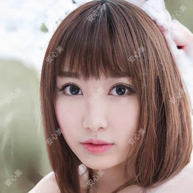 方跃明徐州美莱整形医生:方跃明医生技术实力强,丰富整形实例展示