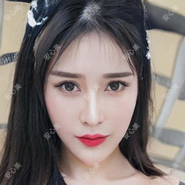 广州视百年眼科项目价格详解:近视激光+白内障+干眼治疗仅需8888元起