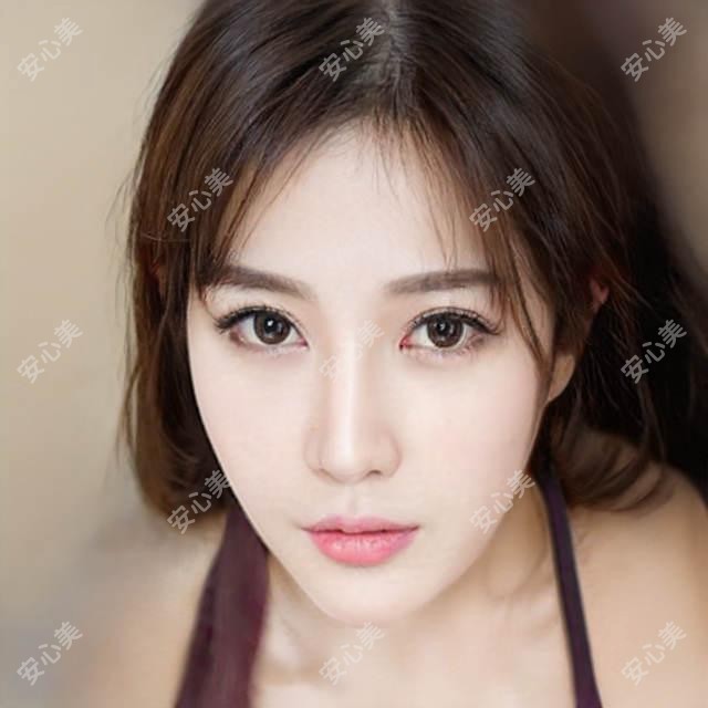 广州医选美价公开：光子嫩肤+玻尿酸填充，这份医美价格表收藏了！