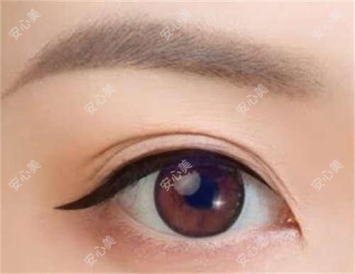 深圳米兰柏羽医美价目表大公开｜玻尿酸、热玛吉、双眼皮项目价格一览