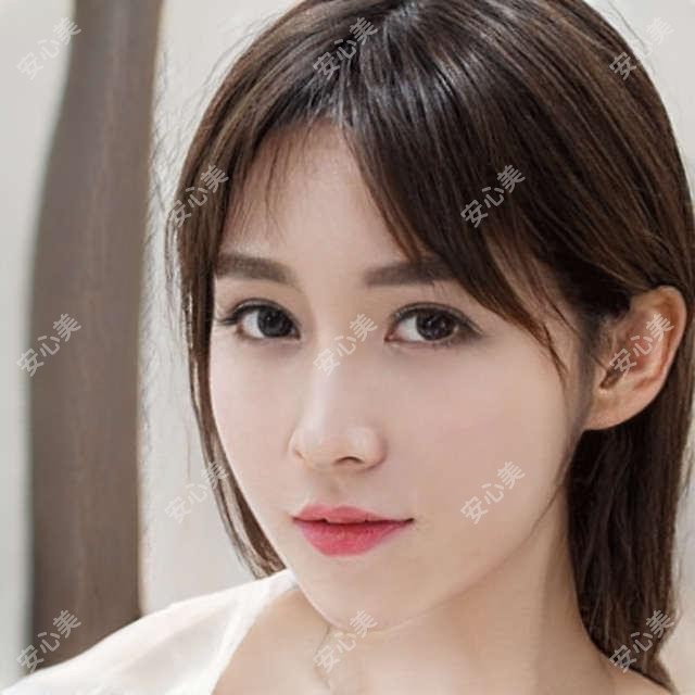 莆田海峡整形傅凤英医生：激光祛斑美肤医生，褐青色痣太田痣稳准治疗