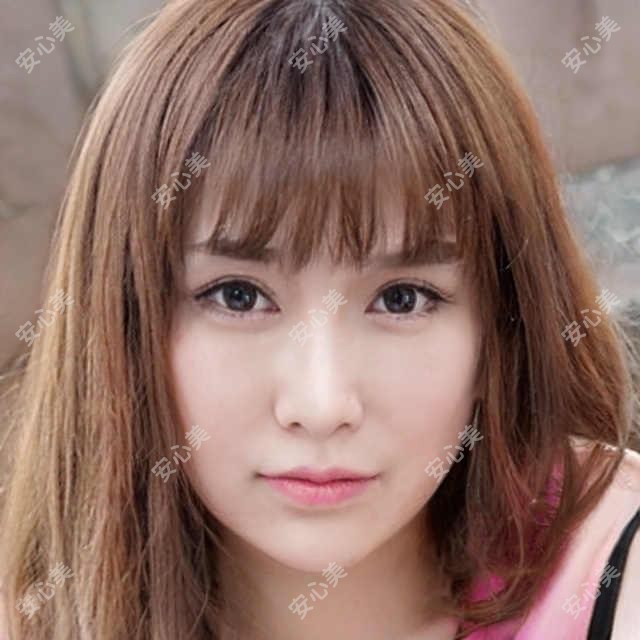 北京医美哪家强?华科皮肤科VS联合丽格,双眼皮&玻尿酸真实测评