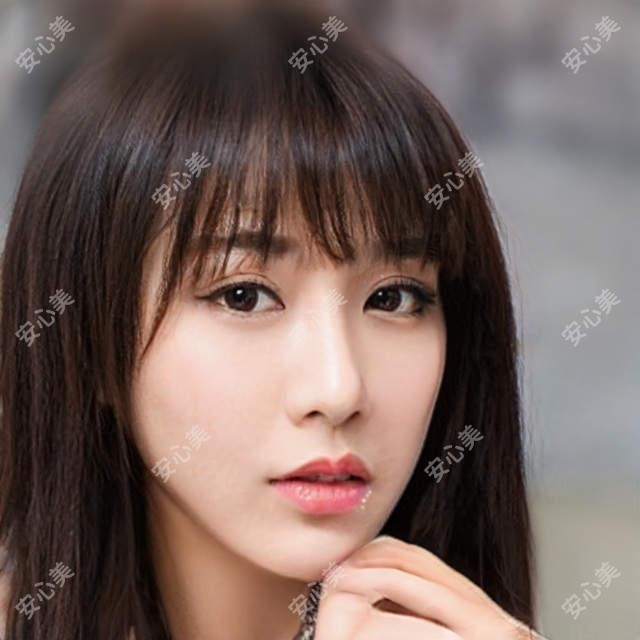 镇江卧蚕填充选玻尿酸还是胶原蛋白?3k和5k价位疗效对比解析