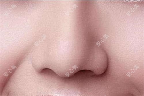 上海眼科医院哪家强?新华医院、和平眼科对比,近视矫正/白内障手术必看攻略