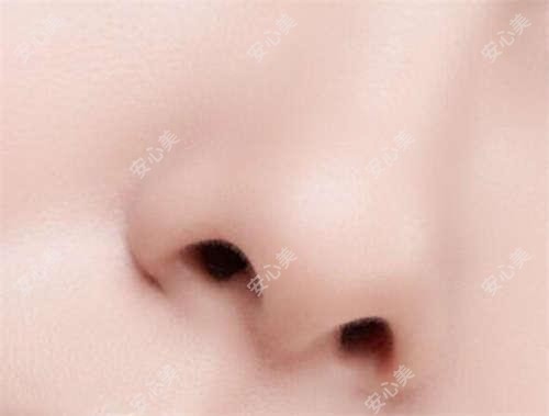 咸阳小白兔口腔邢冉琪医生：种植牙与烤瓷修复医生