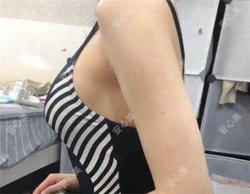 2025广州黄埔区红十字会医院ticl晶体价格表公开:含手术费用及详细项目对比!