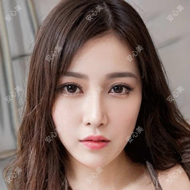 长春南关区白内障手术医生刘景祥怎么样?吉林大学中日联谊医院眼科医生推荐!