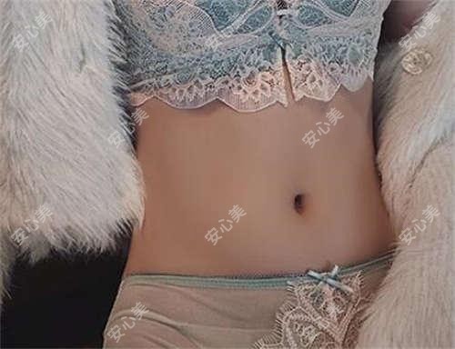 上海优嘉美医疗美容面部吸脂多少钱?吸脂2W+/埋线提升1.5W+/玻尿酸填充3K+
