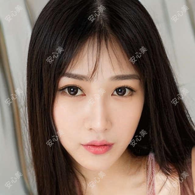成都双下巴吸脂失败修复大概是多少钱?8860元可做,术前指南教你不被坑