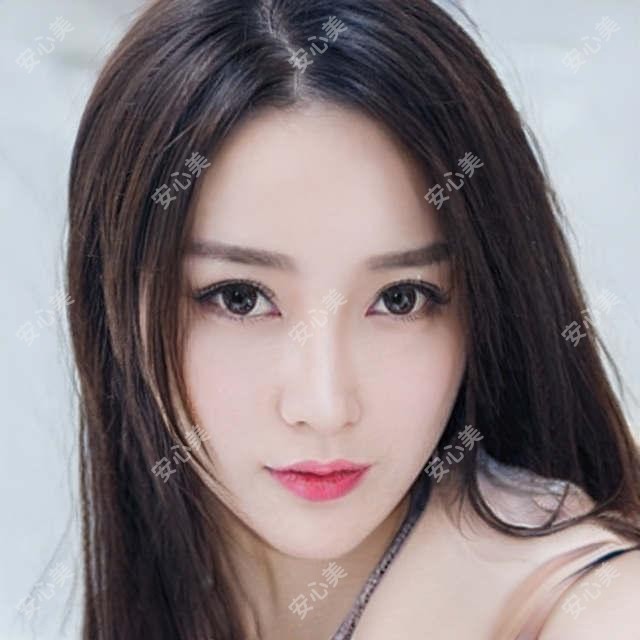 嘉兴微笑唇项目4980元起,塑形饱满疗效自然,但维持期只有6-8个月