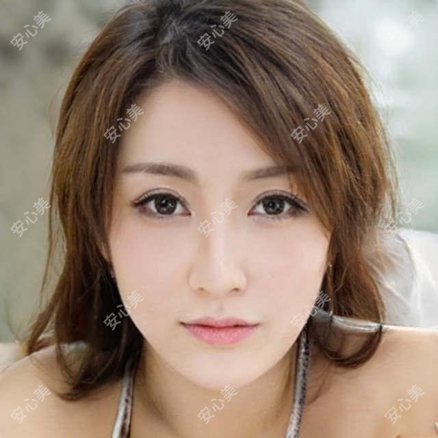 朱秀姐牙齿矫正疗效好吗？擅长隐形矫正和冷光美白，莆田口腔修复医生