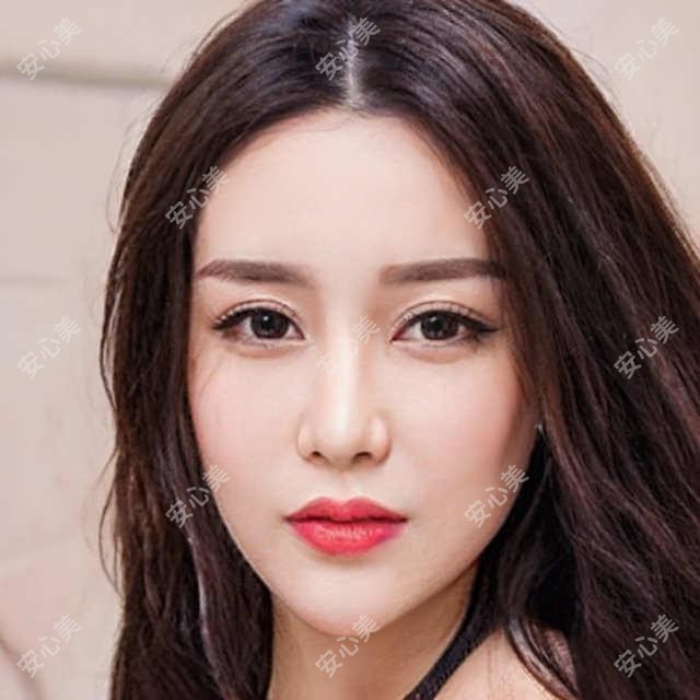 合肥微晶瓷丰苹果肌哪一个医院好？2025排行:合肥华美整形外科医院、爱呀呀诊所、合肥芙罗拉医疗美容等上榜！附价目表