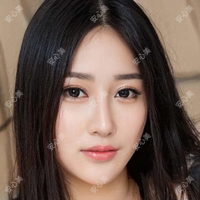 芮艾瑅少女枪:3980元疗效如何?西安哪家机构做芮艾瑅靠谱!