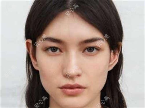 东营艺美李琳医生：30年鼻整形医生，定制自然美鼻与面部微雕