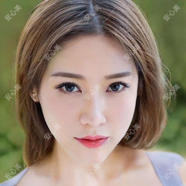 哈尔滨赵信轩医生白内障手术技术精细！黑龙江长庚眼科医生价格详情公开！