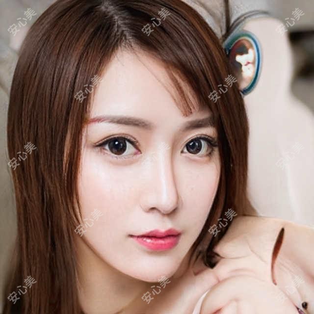 东营丰下巴项目对比:宝尼达和乔雅登哪个更适合你