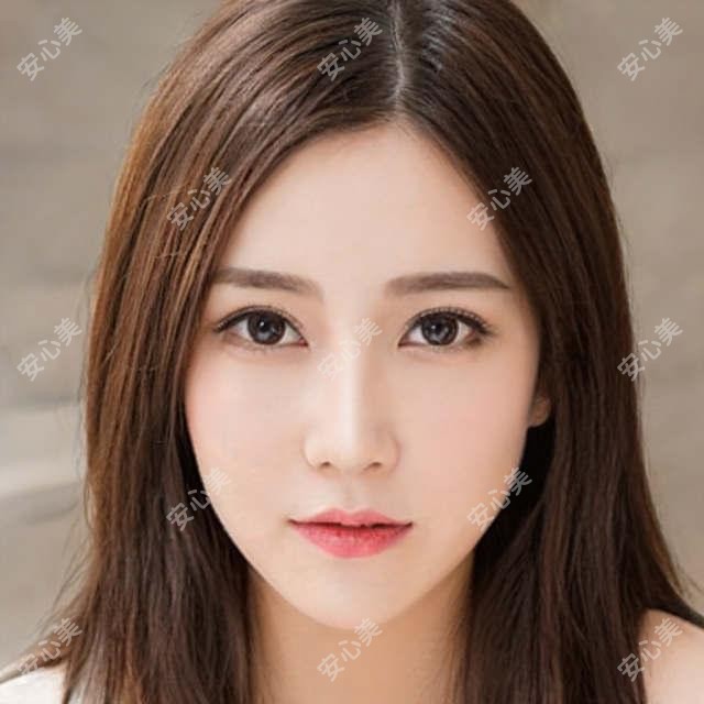 游学敏牙齿矫正成都极光口腔:游可亲医生矫正技术优还有丰富正畸实例
