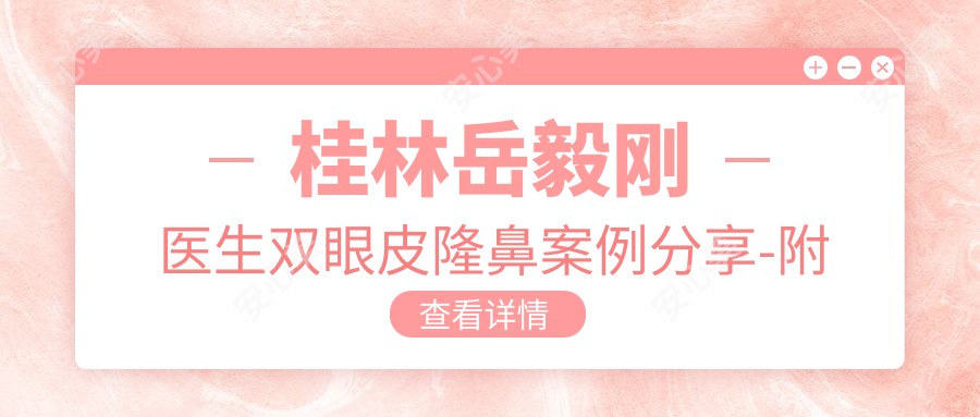 桂林岳毅刚医生双眼皮隆鼻实例分享-附医院整形科项目价格表