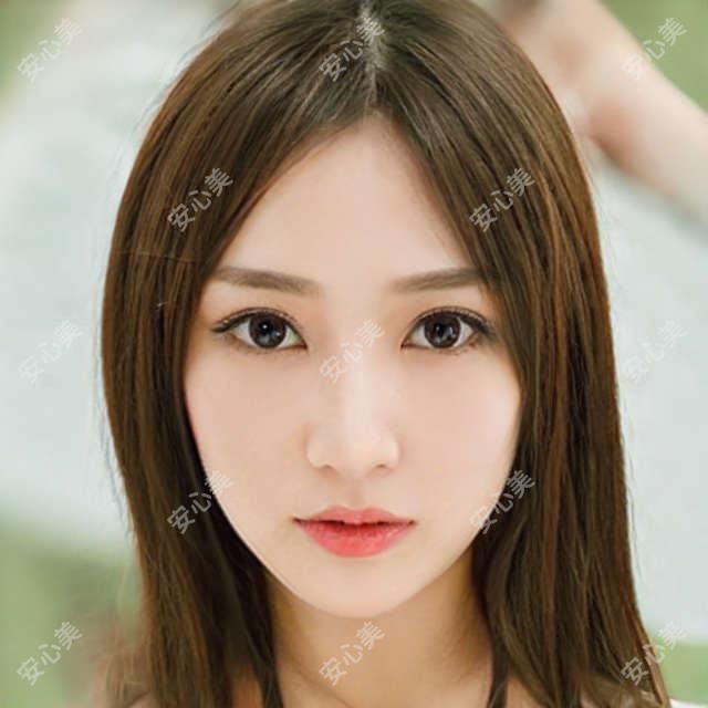 北京颧骨整形价格对比：圣嘉荣28800 vs 艺星19800，医生详解实例与费用